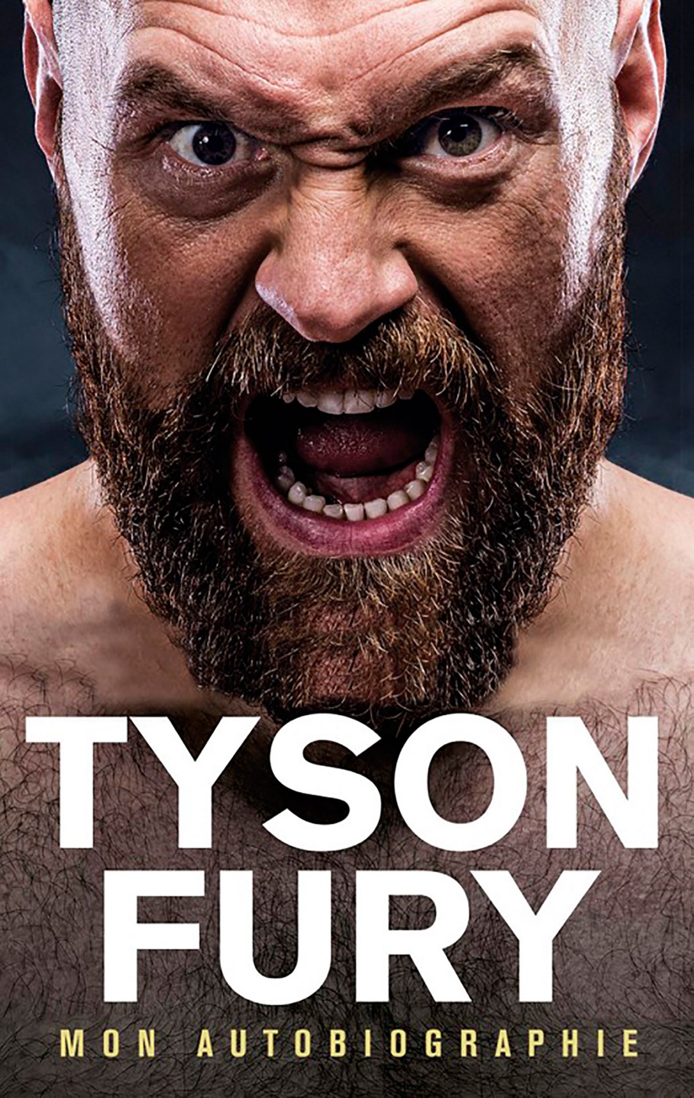 Tyson Fury